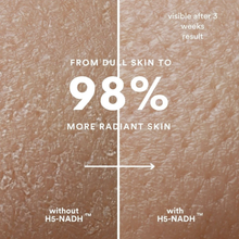 Laden Sie das Bild in den Galerie-Viewer, NEW Inner Beauty with H5-NADH™