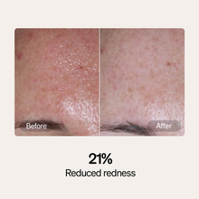 Carica l'immagine nel visualizzatore di Gallery, LYMA Serum & Cream Refills