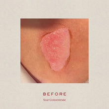 Carica l'immagine nel visualizzatore di Gallery, Scar Concentrate