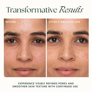 REFINING LOTUS GEL SERUM-CRÈME