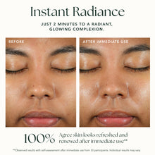 Laden Sie das Bild in den Galerie-Viewer, RADIANT RANI Resurfacing AHA Saffron Masque
