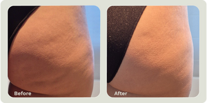 Strong Body Gel