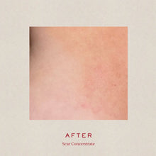 Carica l'immagine nel visualizzatore di Gallery, Scar Concentrate